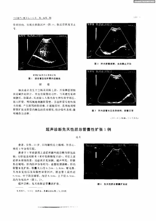 超声诊断先天性胆总管囊性扩张1例