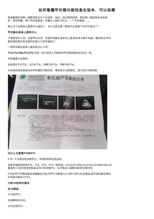 如何看懂甲状腺功能检查化验单，可以收藏