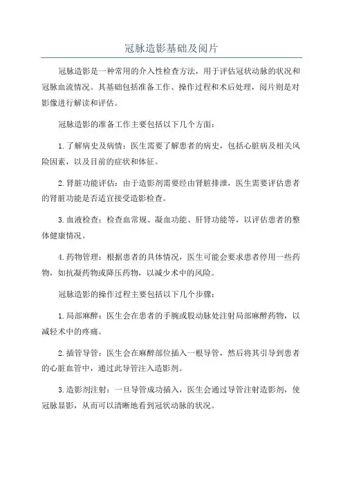 冠脉造影基础及阅片