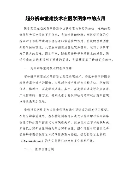 超分辨率重建技术在医学图像中的应用