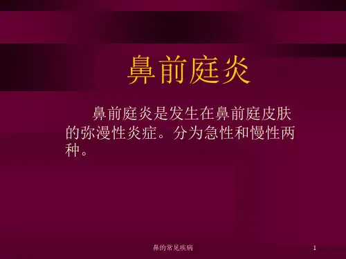 鼻的常见疾病课件