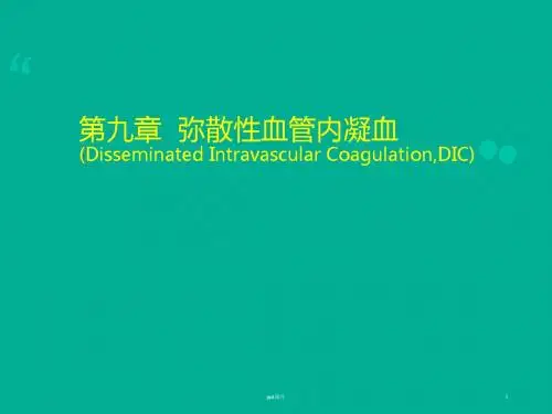弥散性血管内凝血  ppt课件