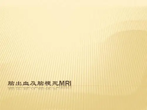 脑出血及脑梗死PPT精品医学课件
