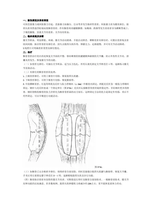膑骨骨折
