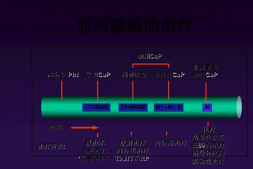 前列腺癌的CAB及IHT治疗