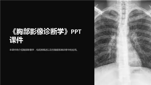 《胸部影像诊断学》课件