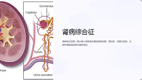 内科护理学课件-肾病综合征