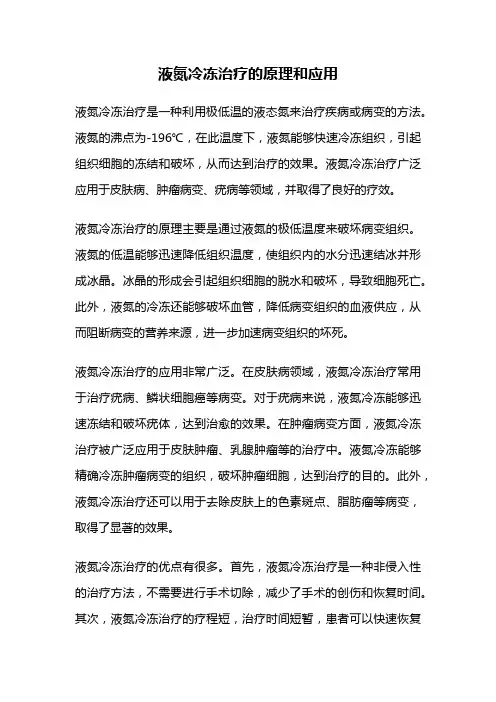 液氮冷冻治疗的原理和应用