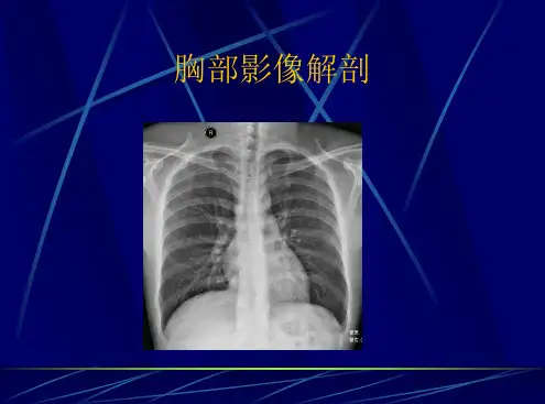 胸部影像解剖剖析