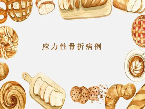 应力性骨折的影像表现