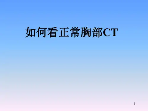 正常胸部CT解剖精品PPT课件
