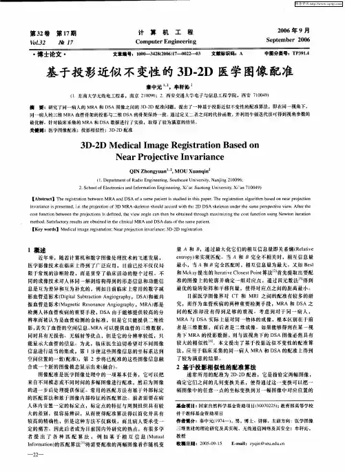 基于投影近似不变性的3D-2D医学图像配准