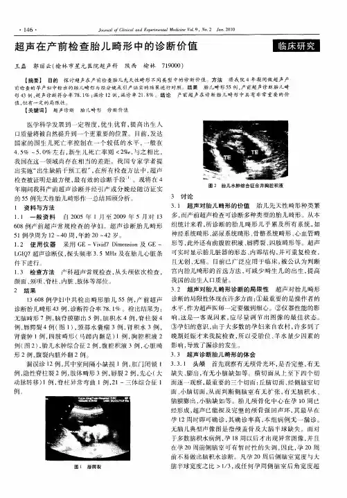 超声在产前检查胎儿畸形中的诊断价值