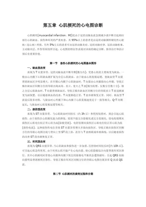 第五章 心肌梗死的心电图诊断