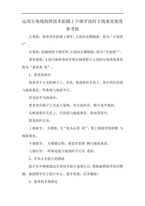 运用分角线投照技术拍摄上下颌牙齿时X线垂直角度参考值