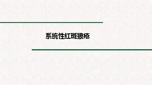 系统性红斑狼疮