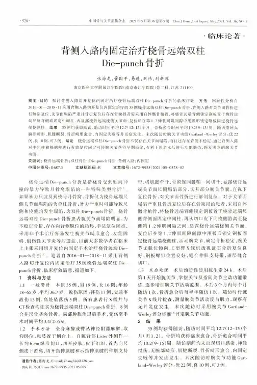 背侧入路内固定治疗桡骨远端双柱Die-punch骨折