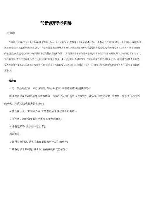 气管切开手术图解