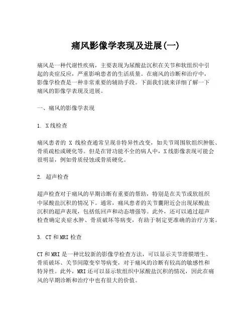 痛风影像学表现及进展(一)
