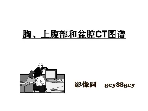 胸、腹、盆腔CT