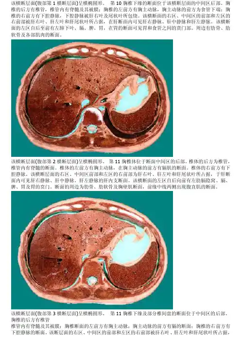 腹部断层解剖彩图