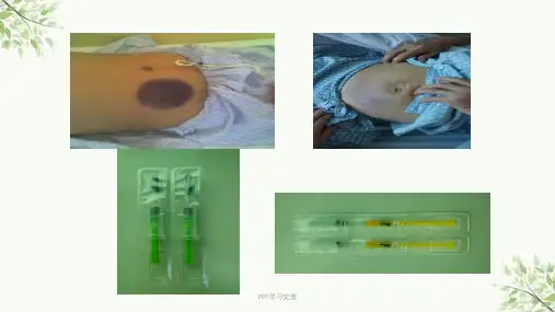 低分子肝素的使用及注意事项课件