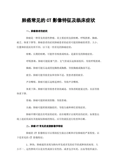 肺癌常见的CT影像特征及临床症状