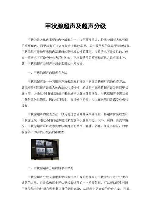 甲状腺超声及超声分级