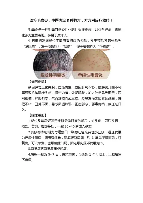 治疗毛囊炎，中医内治8种验方，方方对症疗效佳！