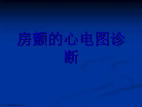 房颤的心电图诊断