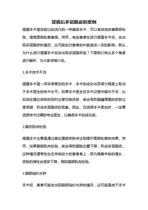 提眉后多层眼皮的案例