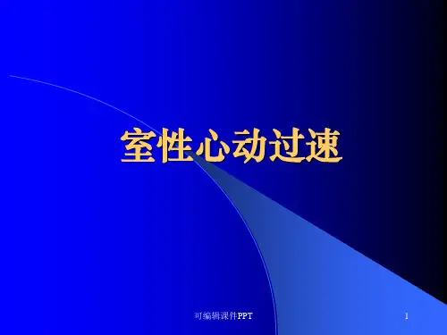 室速心电图ppt课件