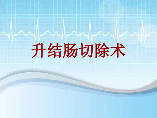 手术讲解模板：升结肠切除术