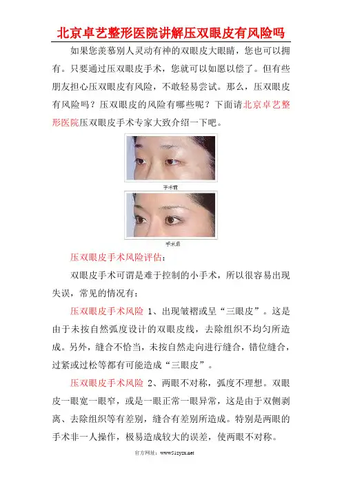 压双眼皮有风险吗？