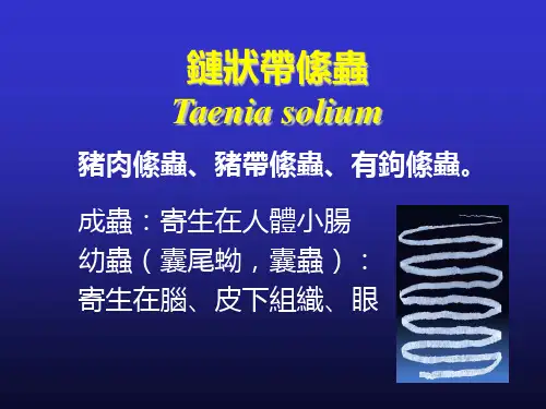 链状带绦虫课件