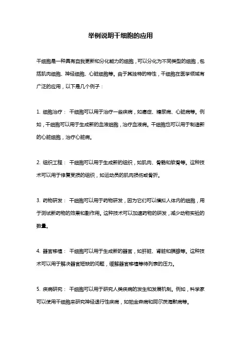 举例说明干细胞的应用