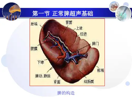 脾破裂的超声诊断PPT课件