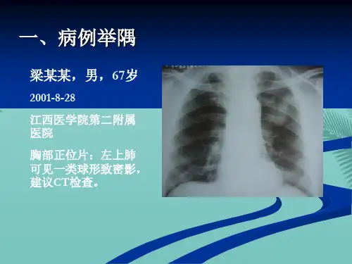 中医治疗肿瘤新策略以肺癌为例.优秀精选PPT