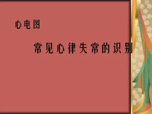 常见心律失常心电图PPT课件