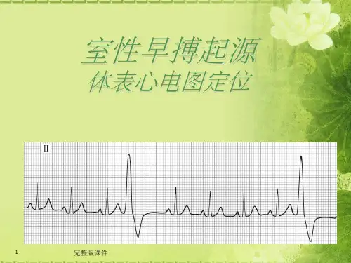 室性早搏起源精选ppt