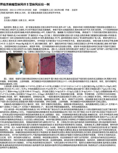 界线类偏瘤型麻风伴Ⅱ型麻风反应一例