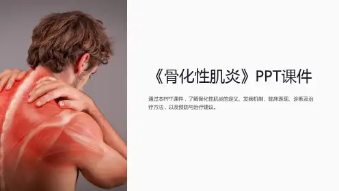 《骨化性肌炎》课件
