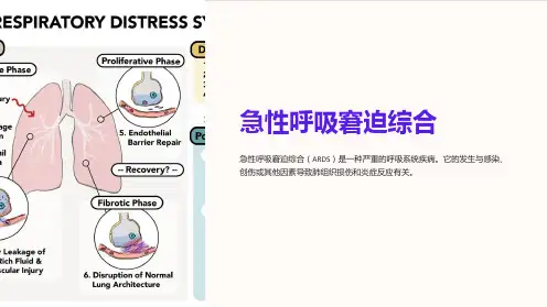 急性呼吸窘迫综合