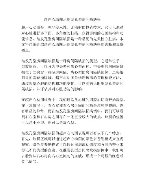 超声心动图示继发孔型房间隔缺损