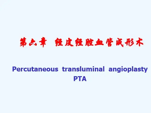 经皮经腔血管成形术