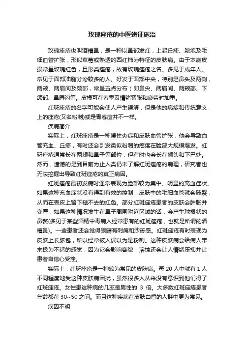玫瑰痤疮的中医辨证施治