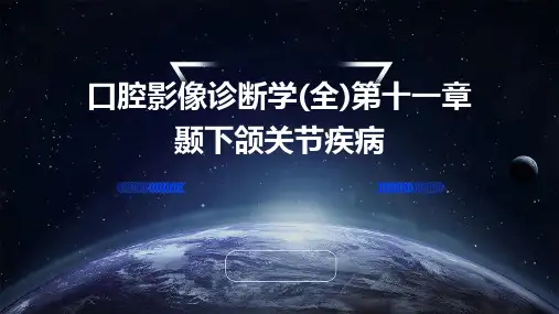 口腔影像诊断学(全)第十一章颞下颌关节疾病
