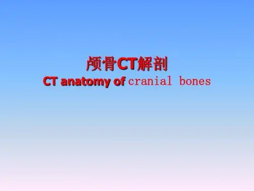 颅骨CT解剖