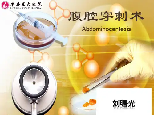 腹腔穿刺术