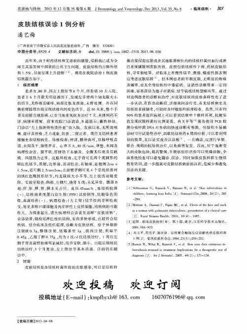 皮肤结核误诊1例分析